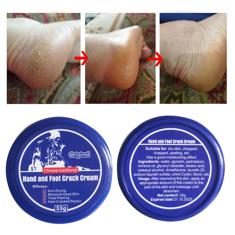 Powerful Traditional Chinese 33g Anti-Drying Crack Foot Cream Heel Cracked Repair Cream Removal Dead Skin Hand Feet Care